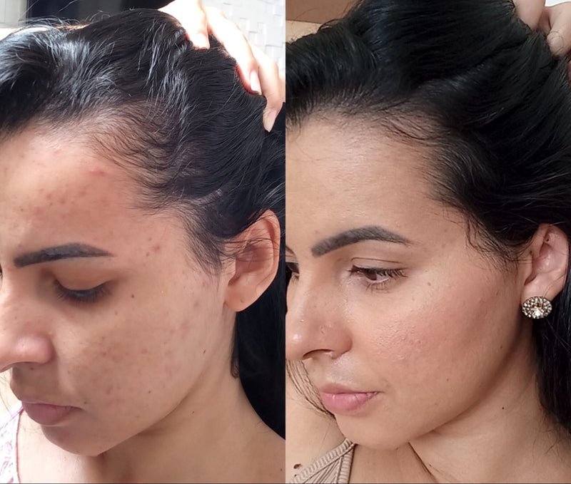 Cabelo e Stress: Como a Saúde Mental Afeta Seus Fios - SOLIV