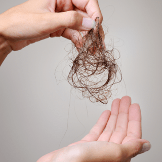 Queda de Cabelo: 5 Causas Mais Comuns e Como Tratar - SOLIV