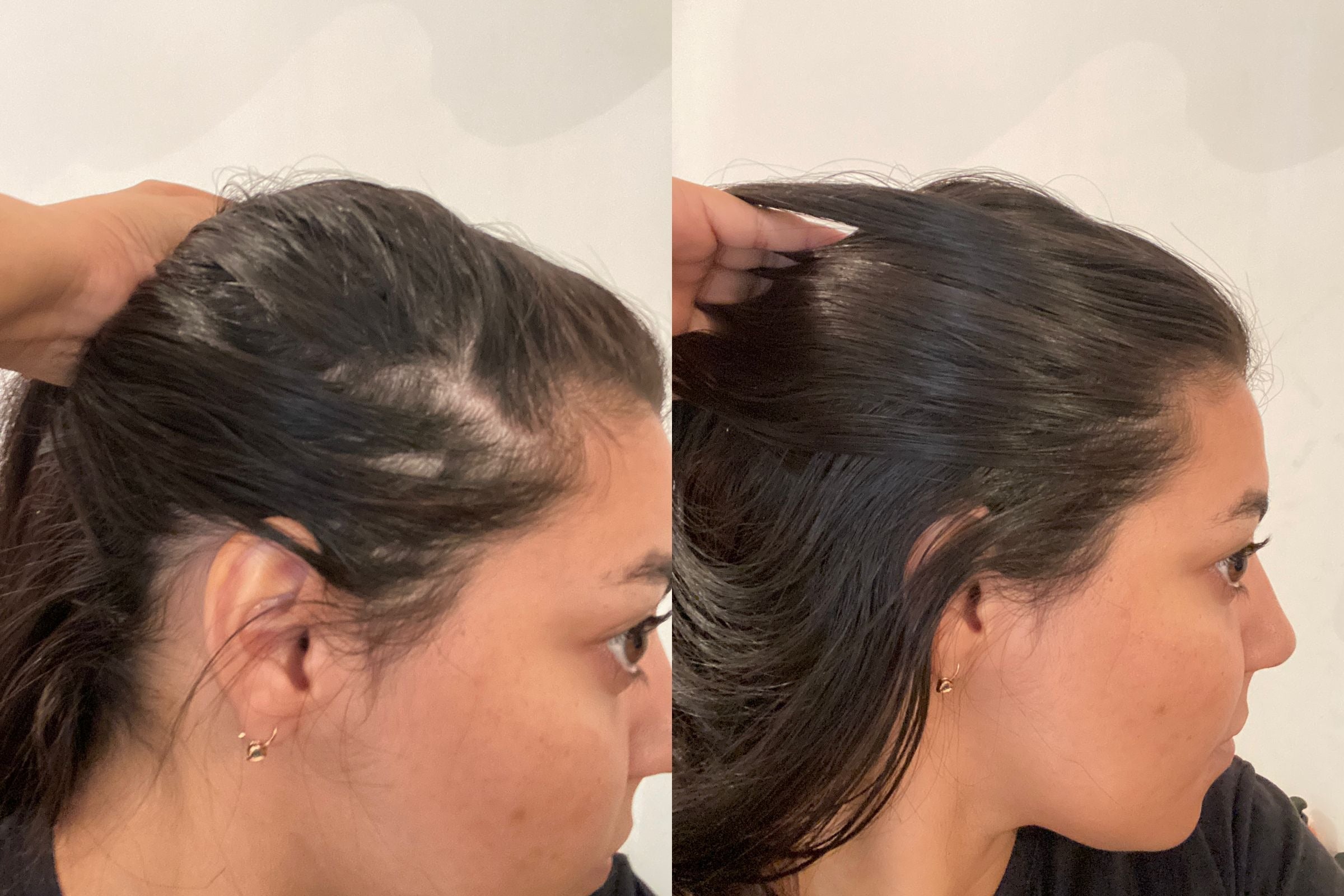 Scalp Saudável: A Base para Cabelos Bonitos e Fortes - SOLIV